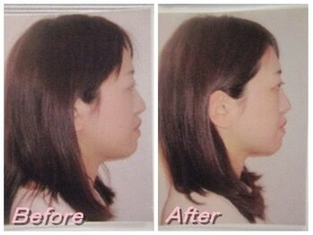 ドクター ヴィーナス/凹凸のある横顔に！