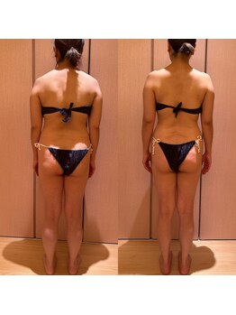 凪 横浜/オールハンドデトックス