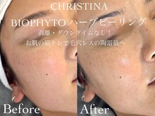 ルチーレ(Lucire)/クリスティーナ　1回目