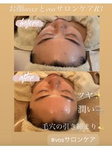 ソラ 六本松店(SORA)/お顔のWax脱毛とVOSサロンケア