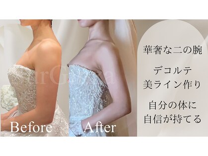 エステサロン シュールの写真