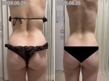 レイル(REIR)の雰囲気（6週プログラム→維持飲み中の私の変化♪今月お得に購入できます!）
