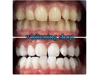ホワイトニングショップ 静岡店/【ホワイトニングで清潔感UP！】