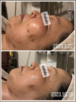 マハロ(mahalo)/月1お手入れ