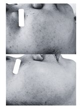 フロート(float)/