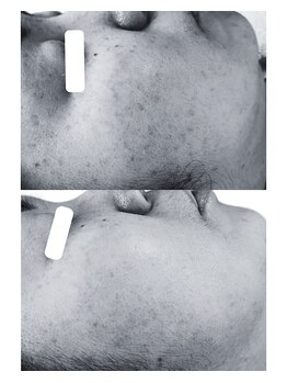 フロート(float)/