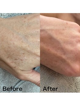 シュシュエステプリューム(Chou Chou Esthe PLUME)/