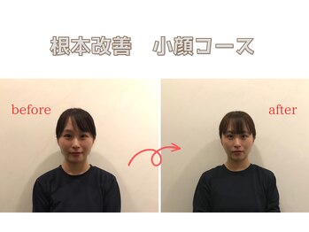 リラクゼーションスペースノーチェ(Noce)/《小顔調整》