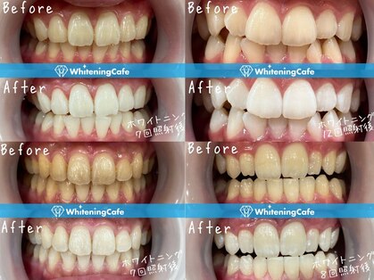 ホワイトニングカフェ 仙台店(WhiteningCafe)の写真