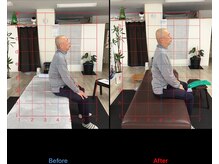 ストレチックス 近江八幡店/姿勢改善ビフォーアフター1回