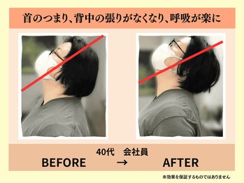 鍼灸整骨院やわら/首の詰まりが抜けた瞬間