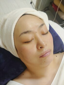 リール ヴィー(Rire Vie)/うる艶美肌シェービングアフター