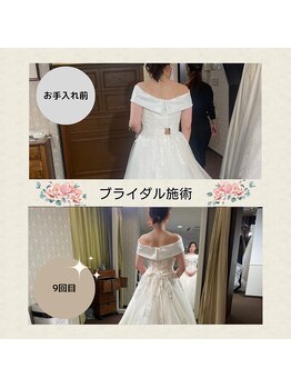 ディア スプリーマ/ブライダルエステ★9回結果出し