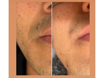 クリスエデン(Clyseden)/