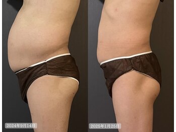 サロンドカメリア(salon de Camellia)/2.5ヶ月でー14kg!