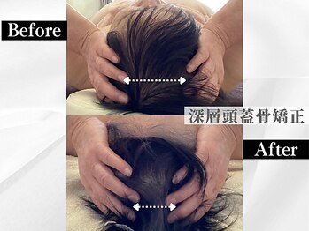 ポーベルポー(Peau Belle poe)/【自律神経整う】深層頭蓋骨矯正