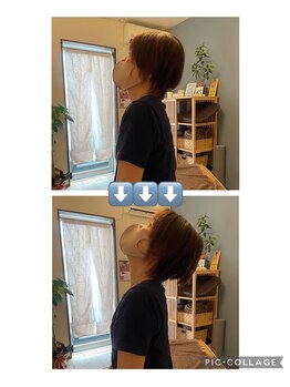 和の整体院みらいく/ビフォーアフター