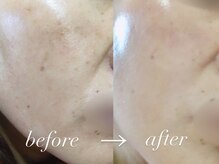 ラ ルーナ 本町(La Luna)