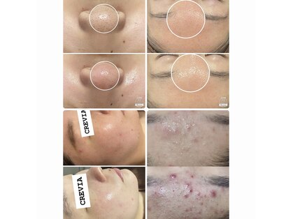 クレビア(CREVIA)の写真