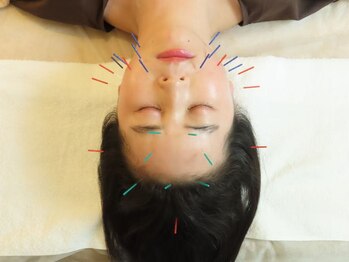 ジョンファ目黒鍼灸院/美容鍼＆身体のもみ鍼灸 90分/3