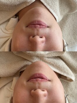 サロン ド ビビ(salon de bibi*)/憧れのVライン