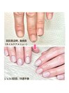 ビフォーアフター