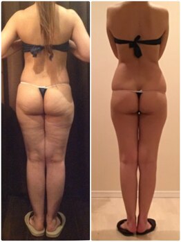 プラチナアース つくば店(Platinum earth)/痩身ビフォーアフター