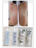 《夏期間限定》足裏角質ケア＆フットワンカラー ¥13,800
