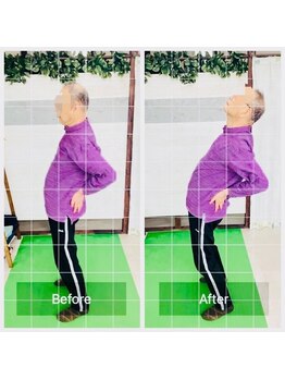 門前仲町イエティ鍼灸整骨院（旧：イエティ鍼灸整骨院）/ビフォーアフター♪