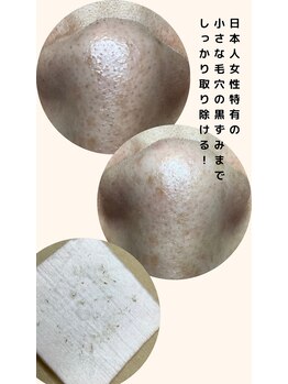 カンパニュラ(campanula)/#毛穴エクストラクション