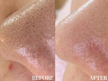 サロン ムスブ(salon MUSUBU)/山梨エステ/甲府エステ