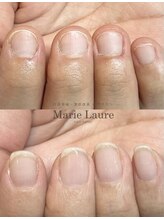 マリーロール 天王寺店(Marie Laure)/自爪育成/深爪矯正/ネイルケア