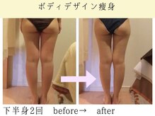 ボディデザインホームクレアフェリーチェ 神戸(Body design home Crea felice)/ボディデザイン痩身・下半身