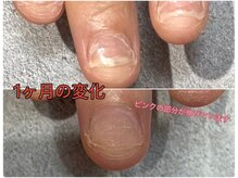 グレースレディ/1ヶ月でこの違い