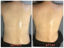 ザ レディービー(The Lady B)/背中肉撃退