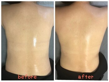 ザ レディービー(The Lady B)/背中肉撃退