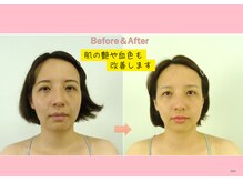 円山カラダ/肌の艶や血色も改善