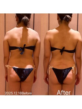 凪 横浜/オールハンドデトックス