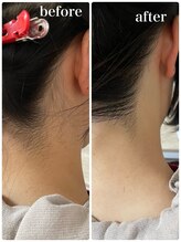 ニコリ(Nicori)/うなじシェービング＆脱毛