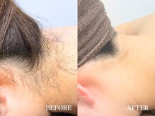 ミース 宮崎店の雰囲気（うなじ矯正専門サロン☆プロが自然で綺麗なうなじに仕上げます！）