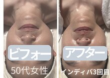 アモル(Amor)