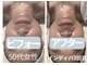 アモル(Amor)の写真