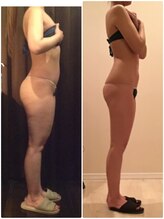 プラチナアース つくば店(Platinum earth)/痩身ビフォーアフター