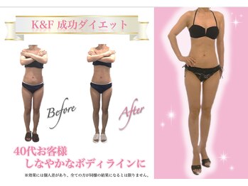 えすてさろん ケイアンドエフ(k&f)/下腹・太ももダイエット成功40代