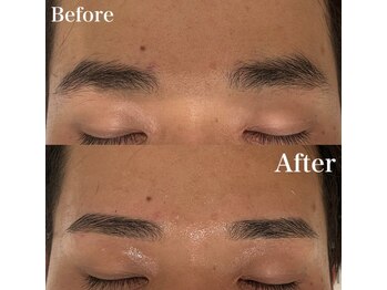 モテテ(motete)/お客様施術例☆栄本店