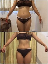 フォルティシモ ビューティ リラックス/小顔／エステ／お腹/ダイエット