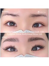 スウィートアイズ(Sweet eyes)/LEDバインドロック120&HBL