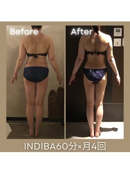 ソレイユ/インディバ痩身