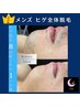 【メンズ】 メンズ１番人気★ヒゲ全体脱毛　１回→￥2,000