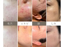 アイランドハーブ 沖縄おもろまち店の雰囲気（医師推薦サロンによる結果重視のフェイシャルケア）